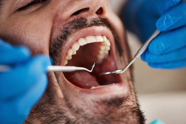Best Urgent Dental Care in Petersburg, IL