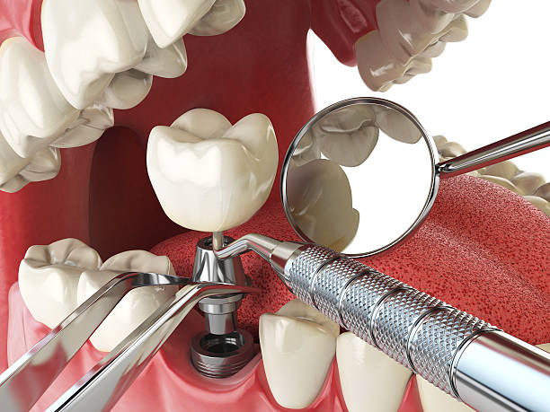 Best After-Hours Emergency Dentist in Petersburg, IL